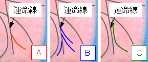 影響線の状態の選択