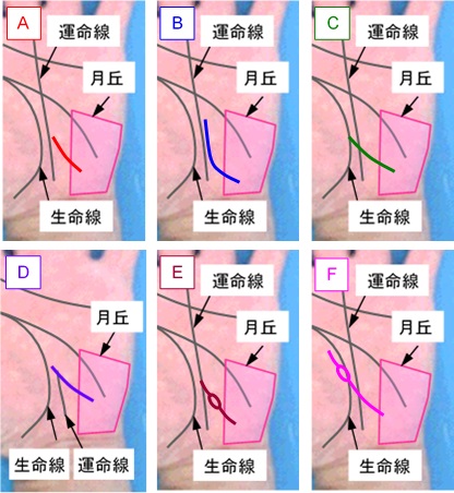 影響線の状態の選択