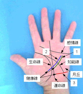 健康線の濃淡・長さ・位置の見方