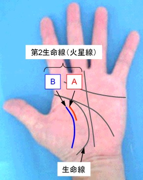 第2生命線（火星線）の状態の選択