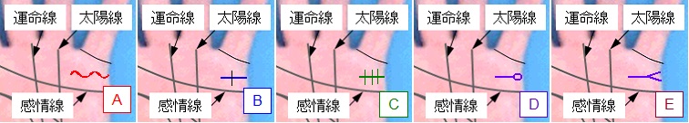 結婚線の状態の選択