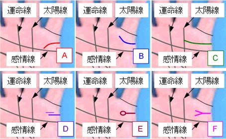 結婚線の先端付近の状態の選択