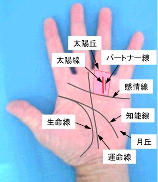 太陽線の本数と状態の選択