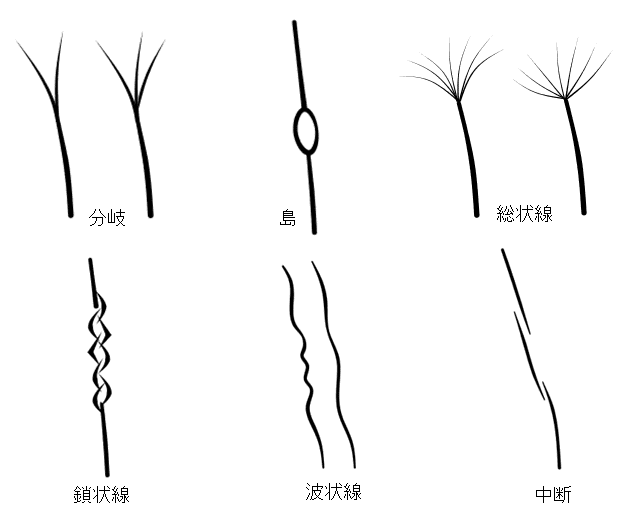 様々な太陽線の種類