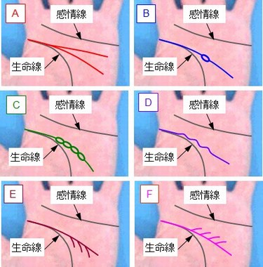 知能線の状態の選択