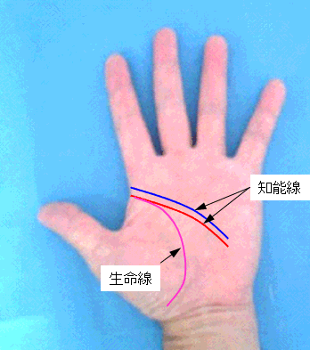 知能線の起点の見方