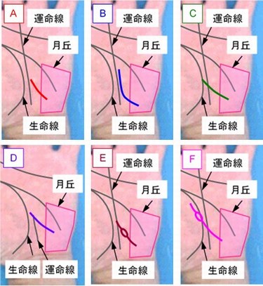 影響線の状態の選択