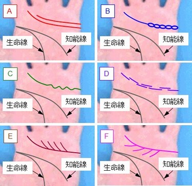 感情線の状態の選択