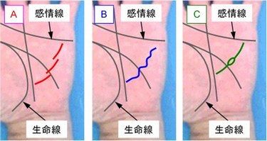 健康線の状態の選択