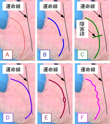 生命線の状態の選択