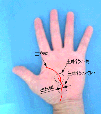 生命線の島と切れ - 手相の見方
