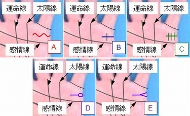 結婚線の状態の選択