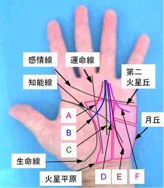 太陽線の起点の選択