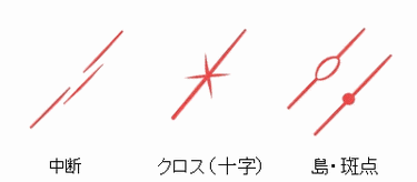 恋愛線が表す様々な恋愛の形