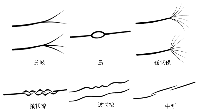 様々な知能線の種類